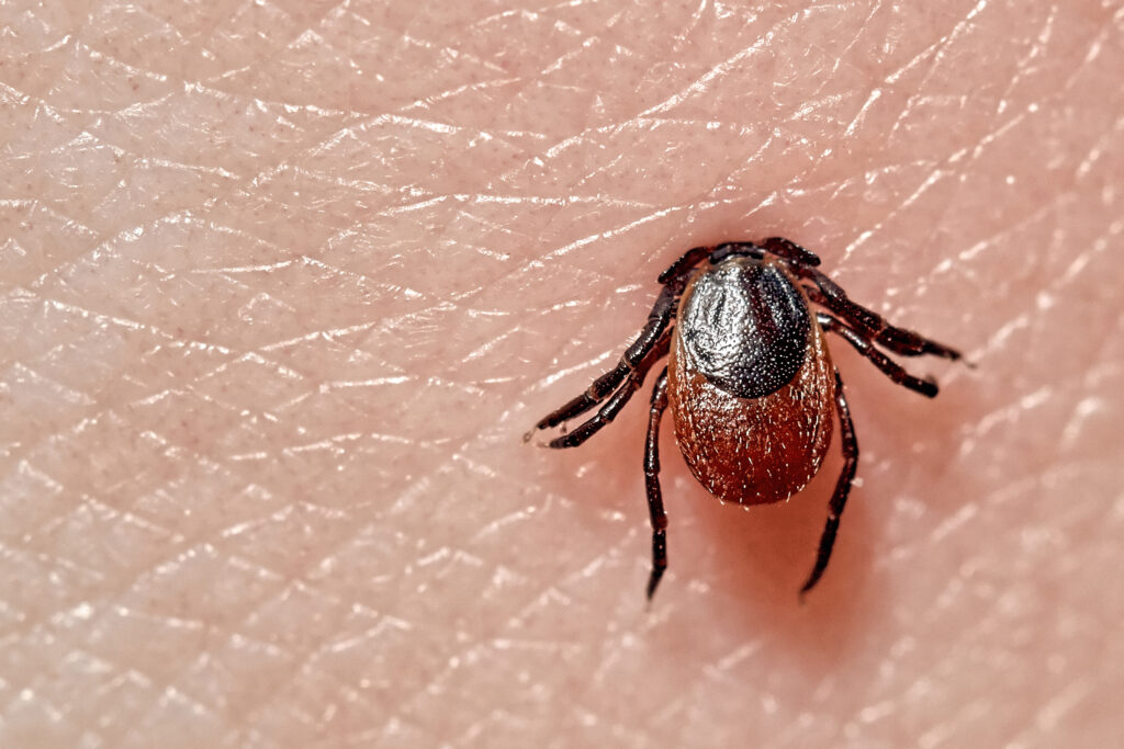 ¿Qué es la enfermedad de Lyme?