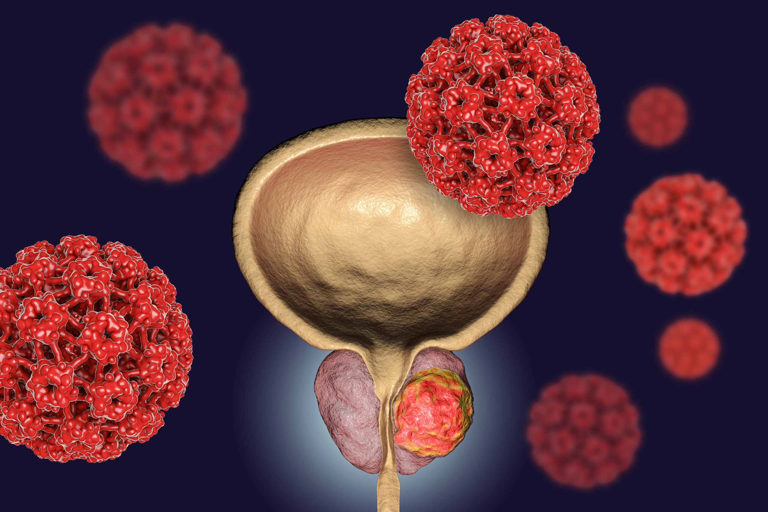 Ocho señales de advertencia del cáncer de próstata