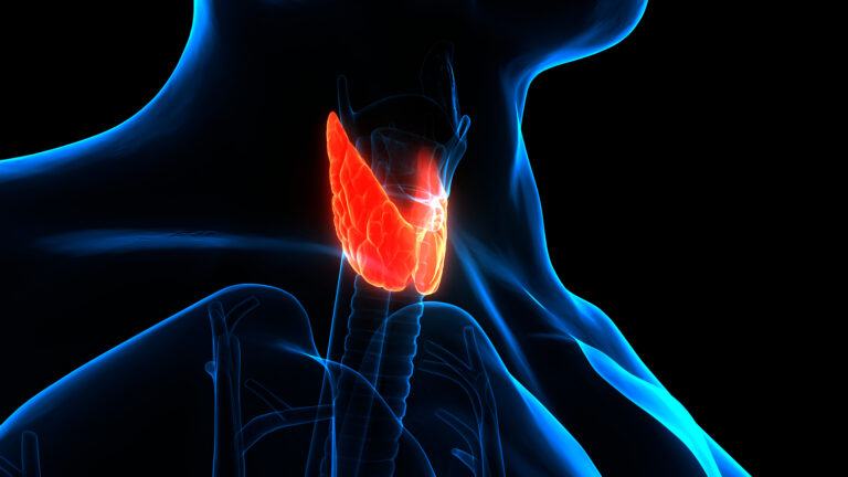 Cinco millones de personas sufren de hipotiroidismo en Colombia
