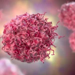 Más jóvenes en riesgo de cáncer