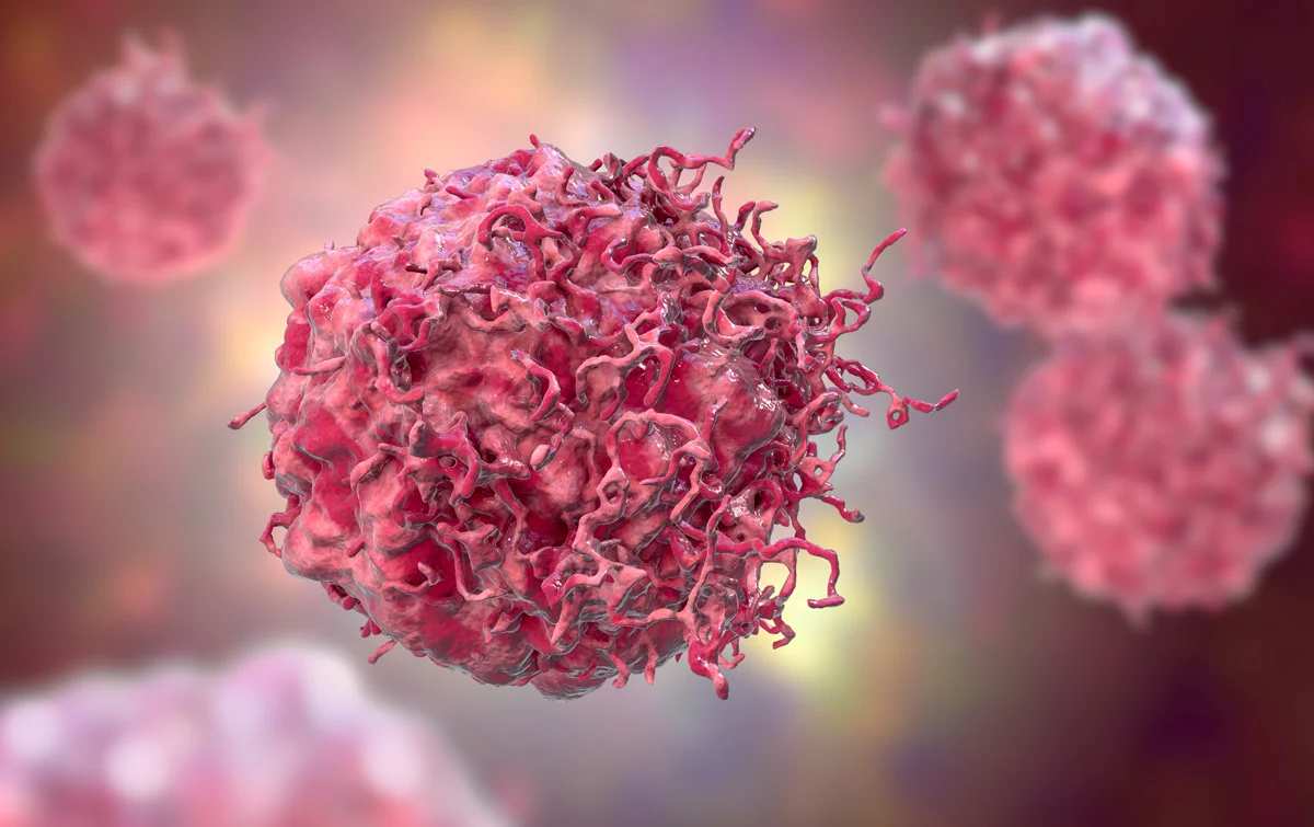 Más jóvenes en riesgo de cáncer